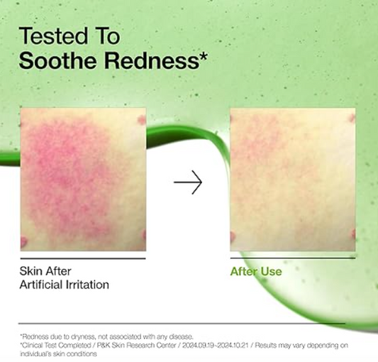 Anua Azelaic Acid 10 Hyaluron Redness Soothing Serum, Facial Serum for Sensitive skin, Hyaluronic Acid, Niacinamide